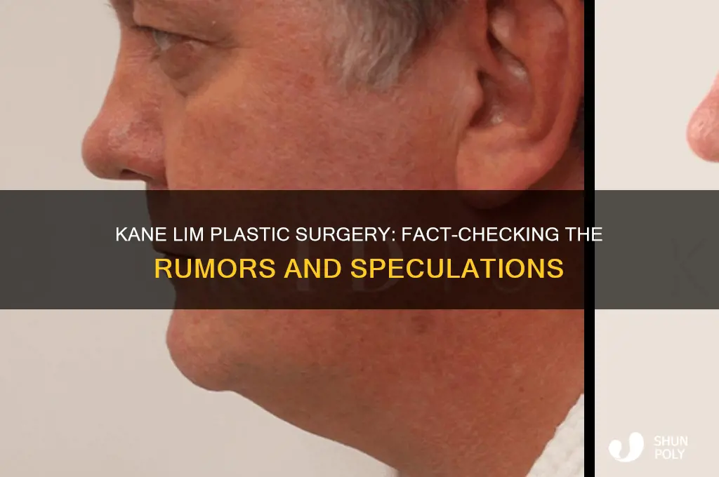 has kane lim had plastic surgery