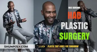 Karamo Brown's Transformation: Plastic Surgery Rumors Explored