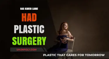 Karen Laine Plastic Surgery: Fact-Checking the Transformation Rumors