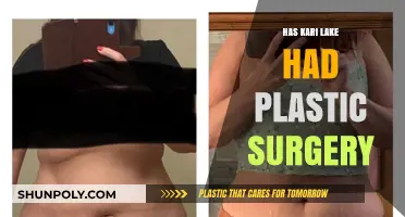 Kari Lake's Transformation: Plastic Surgery Rumors and Speculations Explored