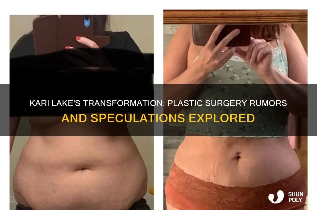 has kari lake had plastic surgery