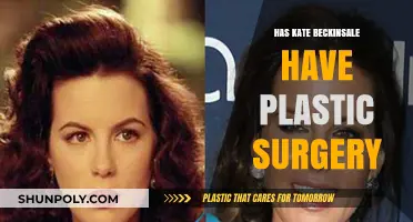 Kate Beckinsale Plastic Surgery: Fact-Checking the Transformation Rumors