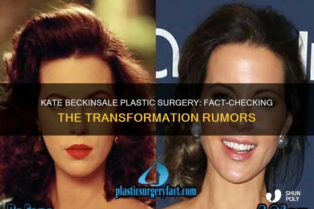 has kate beckinsale have plastic surgery