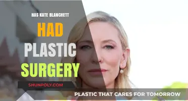 Kate Blanchett's Ageless Beauty: Plastic Surgery Speculations Explored