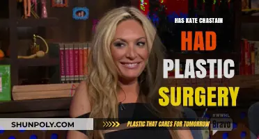 Kate Chastain Plastic Surgery: Fact-Checking the Below Deck Star's Transformation