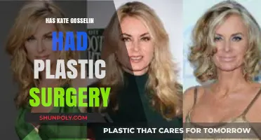 Kate Gosselin's Transformation: Plastic Surgery Rumors and Reality Revealed