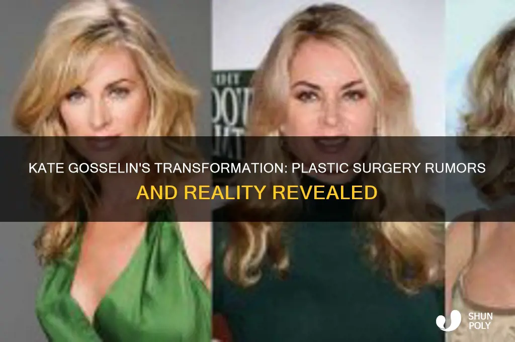 has kate gosselin had plastic surgery