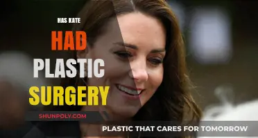 Has Kate Middleton Had Plastic Surgery? Uncovering the Truth