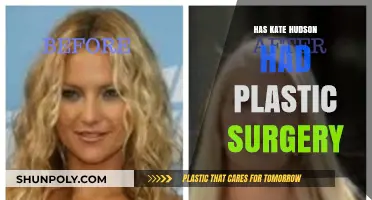 Kate Hudson's Transformation: Plastic Surgery Rumors and Reality Revealed