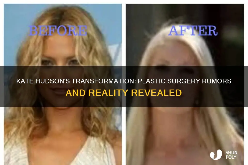 has kate hudson had plastic surgery