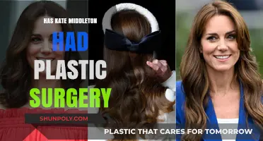 Kate Middleton's Transformation: Plastic Surgery Rumors Explored