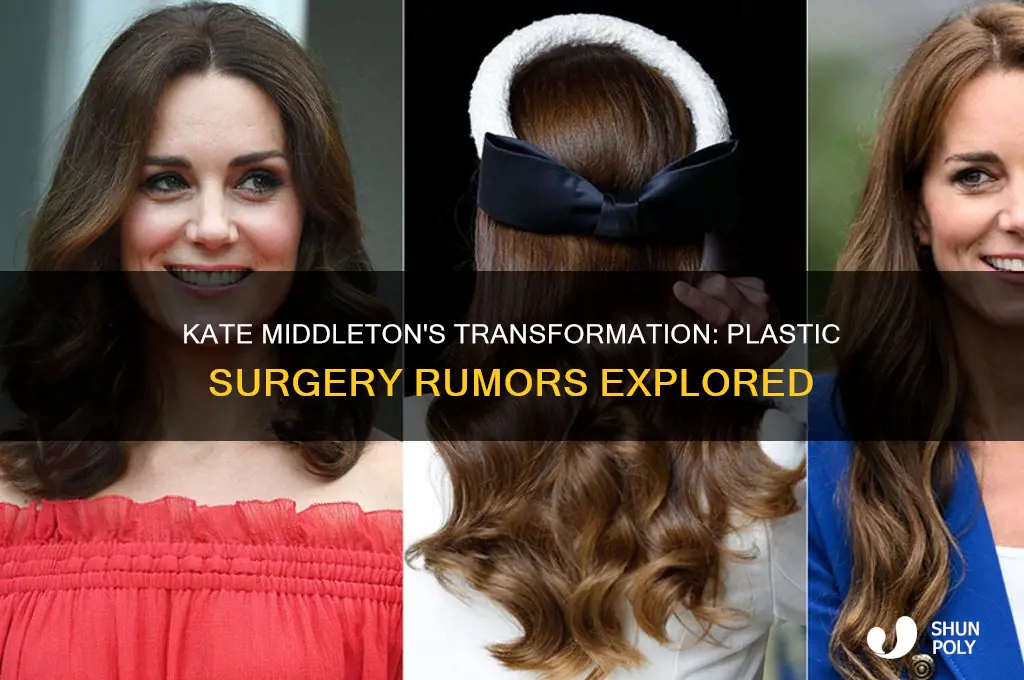 has kate middleton had plastic surgery