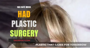 Kate Moss Plastic Surgery: Fact or Fiction? Unveiling the Truth