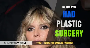 Kate Upton's Transformation: Plastic Surgery Rumors Explored and Debunked