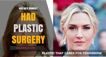 Kate Winslet's Transformation: Plastic Surgery Rumors Explored and Debunked
