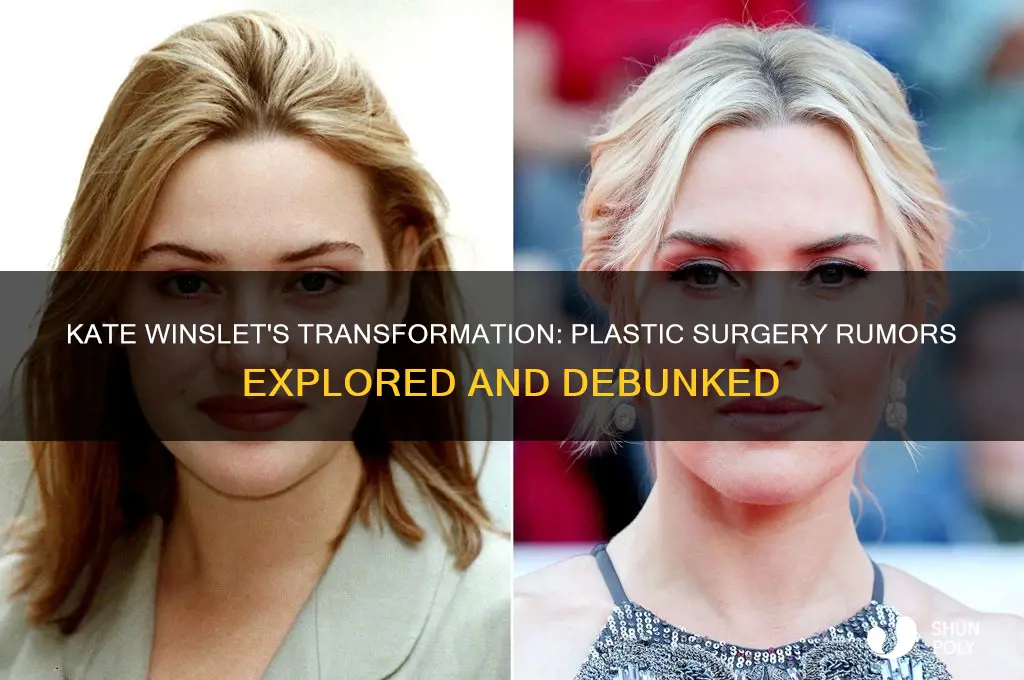 has kate winslet had plastic surgery