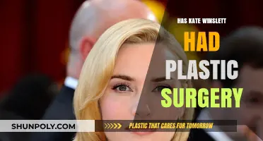 Kate Winslet's Transformation: Plastic Surgery Rumors Explored and Debunked