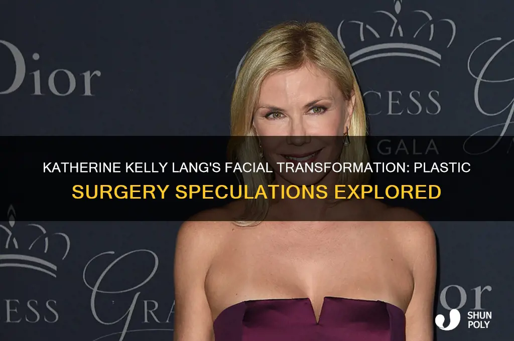 has katherine kelley lang had plastic surgery on her face