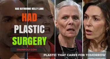Katherine Kelly Lang Plastic Surgery: Fact-Checking the Rumors and Speculations
