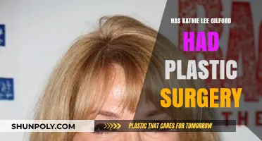 Kathie Lee Gifford's Transformation: Plastic Surgery Speculations Explored