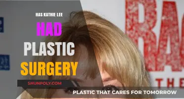 Kathie Lee Gifford's Transformation: Plastic Surgery Speculations Explored