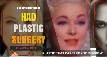 Kathleen Turner's Transformation: Plastic Surgery Speculations and Truths Revealed