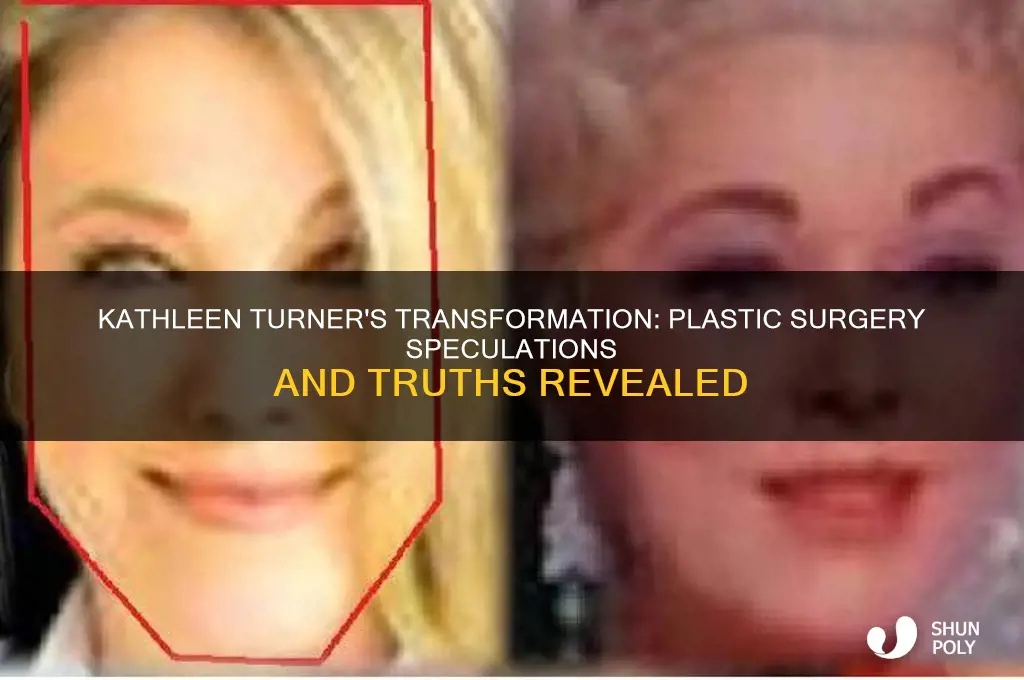 has kathleen turner had plastic surgery