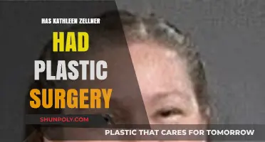 Kathleen Zellner Plastic Surgery: Fact-Checking the Rumors and Speculations