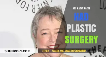 Kathy Bates Plastic Surgery: Unveiling the Truth Behind Her Appearance