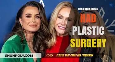 Kathy Hilton's Transformation: Plastic Surgery Speculations and Truths Revealed