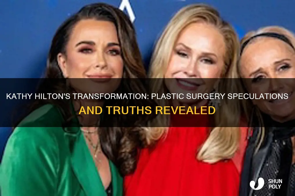 has kathy hilton had plastic surgery