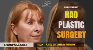 Kathy May's Transformation: Plastic Surgery Speculations and Truths Revealed