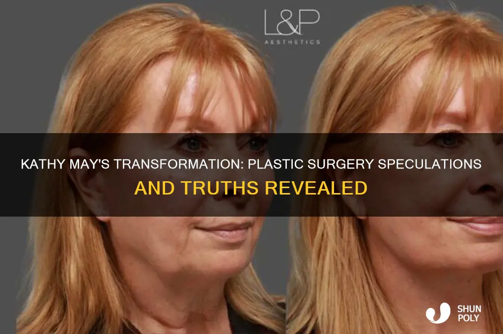 has kathy may had plastic surgery