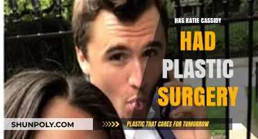 Katie Cassidy's Transformation: Plastic Surgery Rumors and Speculations