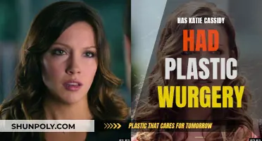 Katie Cassidy's Plastic Surgery: Fact or Fiction?