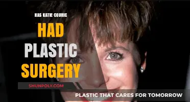 Katie Couric's Transformation: Plastic Surgery Rumors Explored and Debated