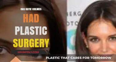 Katie Holmes Plastic Surgery: Fact-Checking the Rumors and Speculations