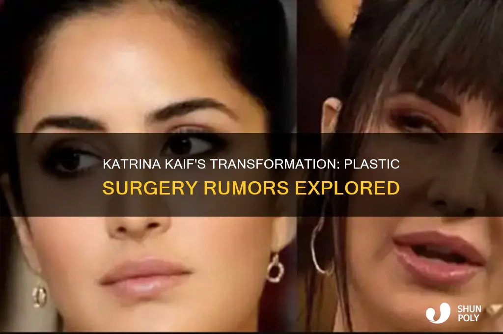 has katrina done plastic surgery