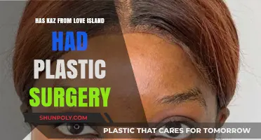 Has Kaz From Love Island Had Plastic Surgery? The Truth