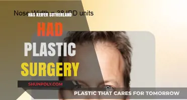 Keifer Sutherland's Changing Looks: Plastic Surgery Rumors Explored