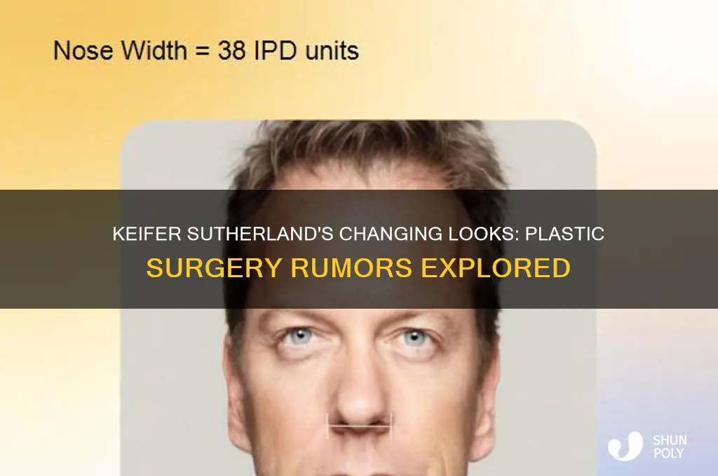 has keifer sutherland had plastic surgery