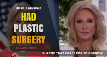 Kellyanne Conway's Transformation: Plastic Surgery Speculations and Facts Revealed