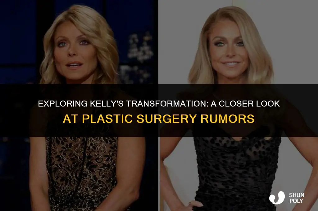 has kelly from ryan and kelly had plastic s