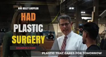 Kelly Loeffler's Appearance: Plastic Surgery Speculations and Rumors Explored
