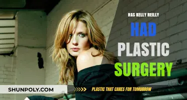 Kelly Reilly's Transformation: Plastic Surgery Rumors and Speculations