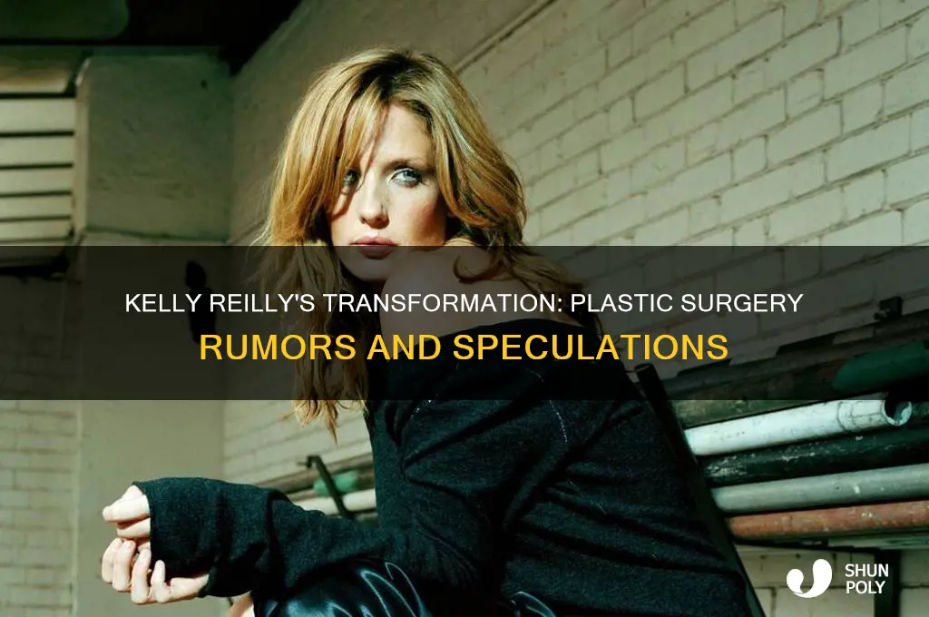 has kelly reilly had plastic surgery