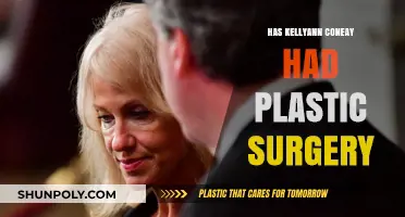 Kellyanne Conway's Appearance: Plastic Surgery Speculations and Truths Revealed