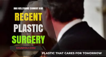 Kellyanne Conway's Recent Appearance: Plastic Surgery Speculations Explored