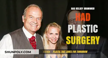 Kelsey Grammer's Transformation: Plastic Surgery Speculations and Truths