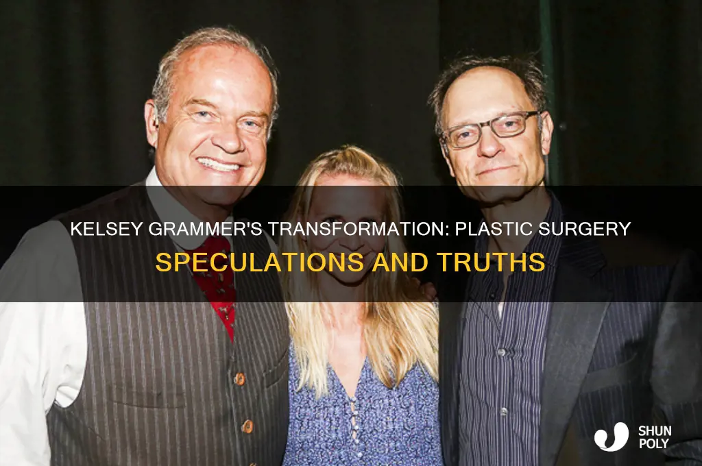 has kelsey grammer had plastic surgery